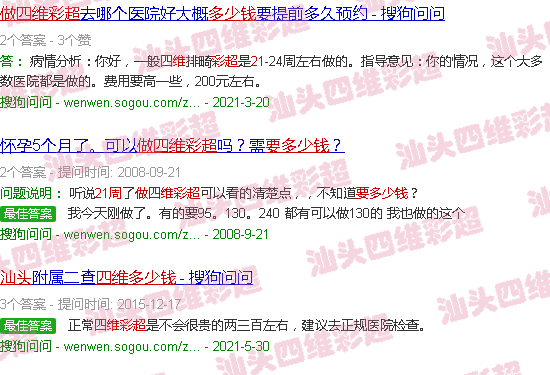  汕头中心医院四维彩超多少钱-汕头21周做四维B超要多少钱