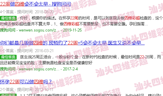  汕头12月28日-汕头22周又5天胎儿四维B超