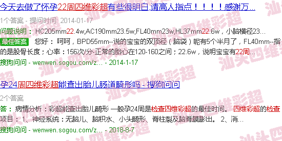  汕头做四维多少钱-汕头22周四维B超检查什么