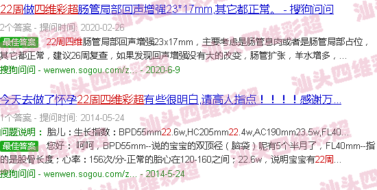 汕头预约四维彩超-汕头22周四维彩超