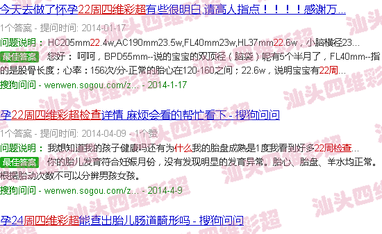  汕头哪里可以做四维-汕头22周四维彩超检查什么