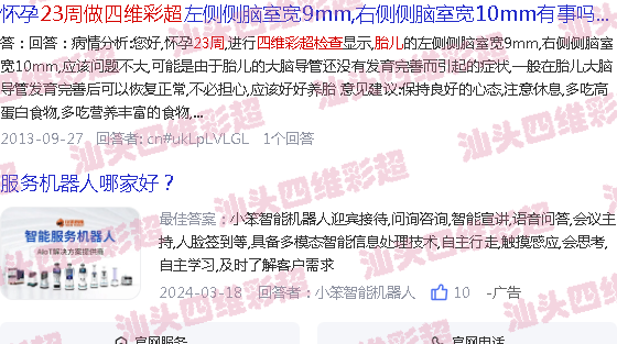  怀孕23周的胎儿视频-汕头23周胎儿做四维b超