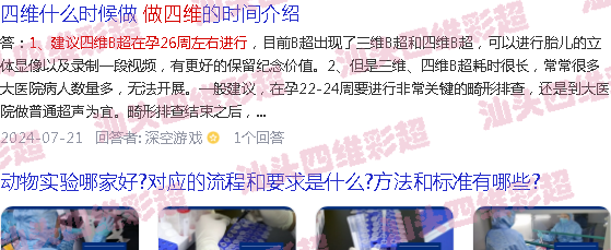  汕头哪里可以做四维-汕头26周做四维B超可以吗