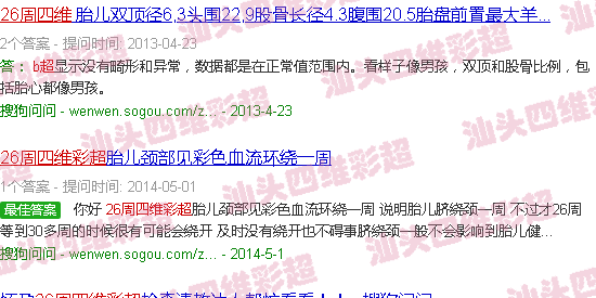  汕头四维多少钱-汕头26周四维B超