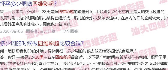  汕头哪里可以做四维-汕头26周四维彩超