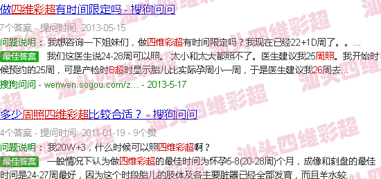  26周拍四维会不会晚-汕头26周照四维B超