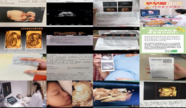  汕头怀孕做四维多少钱啊 - 汕头怀孕做四维多少钱