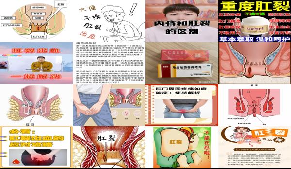  月子肛裂出血怎么治愈 - 汕头月子肛裂出血怎么办