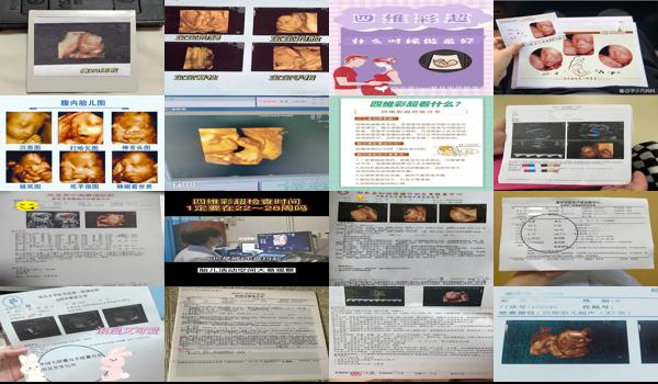  汕头市做四维哪个医院好 - 汕头多少周做四维最好