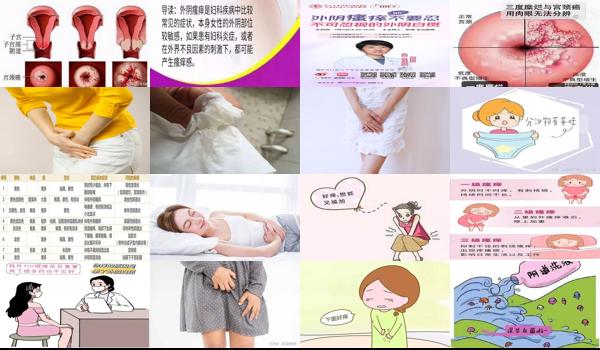 下面外头痒 - 汕头外阴瘙痒会导致不孕吗