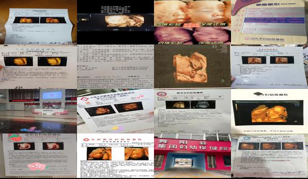  汕头妇幼保健院有做四维吗多少钱 - 汕头妇幼保健院有做四维吗
