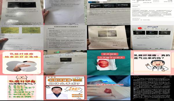  汕头做乳腺纤维瘤需要检查什么项目 - 汕头做乳腺纤维瘤需要检查什么