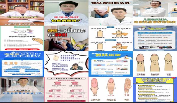  包皮长耽误生育吗 - 汕头包皮长会导致不孕么