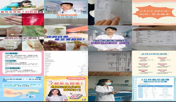  汕头保健院现在可以去看妇科吗 - 汕头保健院有白带检查吗