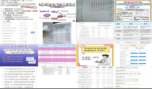  torch检查项目有哪些 - 汕头torch是什么检查项目