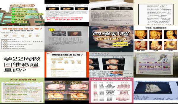  汕头市做四维哪个医院好 - 汕头四维几周做最佳时间