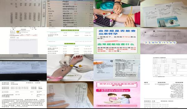  汕头抽血检查能查要多少钱一次 - 汕头抽血检查能查要多少钱