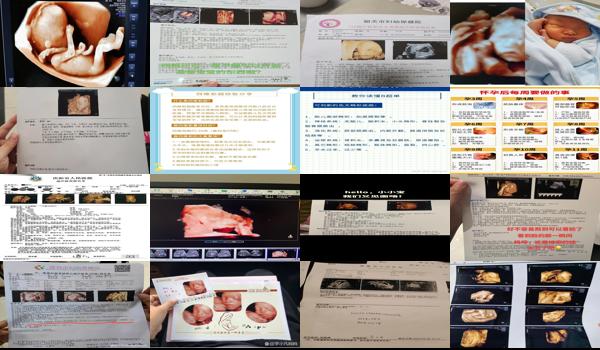 汕头市做四维哪个医院好 - 汕头要做四维需要准备什么