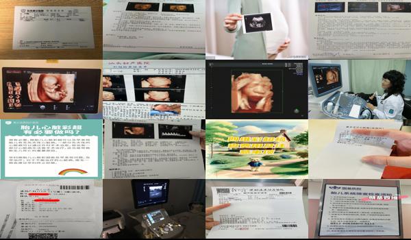  汕头四维彩超费用多少钱呢 - 汕头四维彩超费用多少钱呢