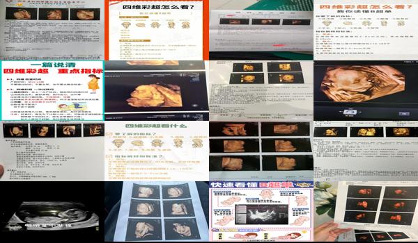  汕头如何看四维彩超的医院 - 汕头如何看四维彩超