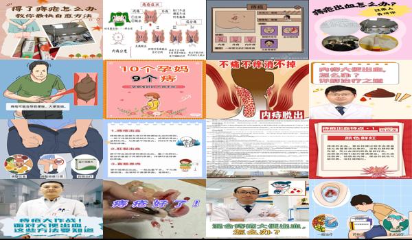  坐月子便秘长痔疮怎么办 - 汕头坐月子大便长痔疮怎么办