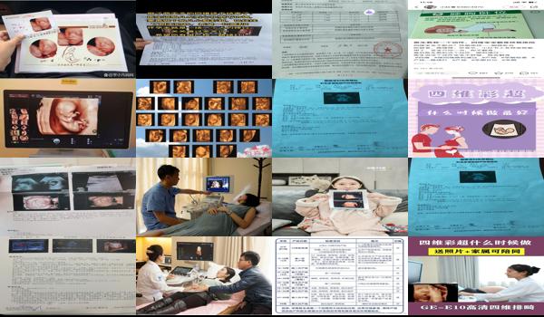  汕头四维检查什么时候最好做 - 汕头四维检查什么时候最好