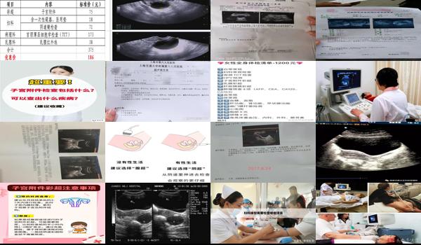  汕头体检子宫附件检查什么项目 - 汕头体检子宫附件检查什么