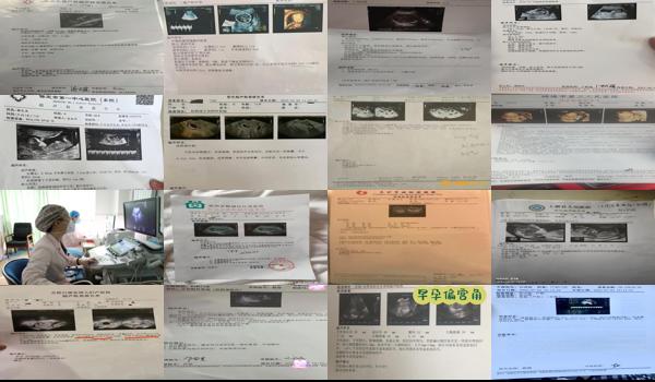  汕头彩超怀孕检查多少钱 - 汕头彩超怀孕检查
