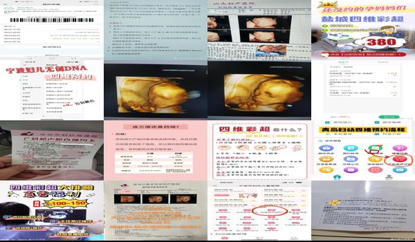  汕头四维用不用预约挂号 - 汕头四维用不用预约