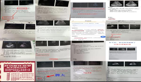  汕头检查肝脏彩超多少钱一次 - 汕头检查肝脏彩超多少钱