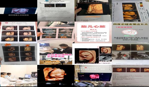  汕头四维多少钱 - 汕头四维什么时候做