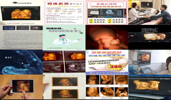  汕头四维彩超预约 - 汕头错过了四维彩超要紧吗